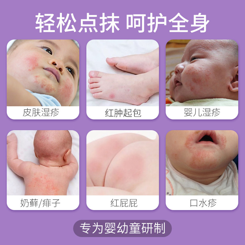健医师紫草婴儿口水湿疹抑菌止痒膏 灿康保健用品皮肤消毒护理（消）