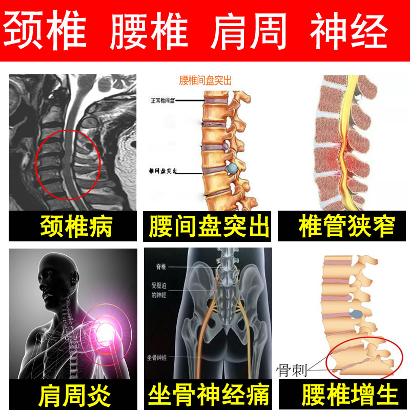 颈椎病肩周炎腰间盘突出腰肌劳损椎管狭窄坐骨神经痛古方膏药贴芳-图2