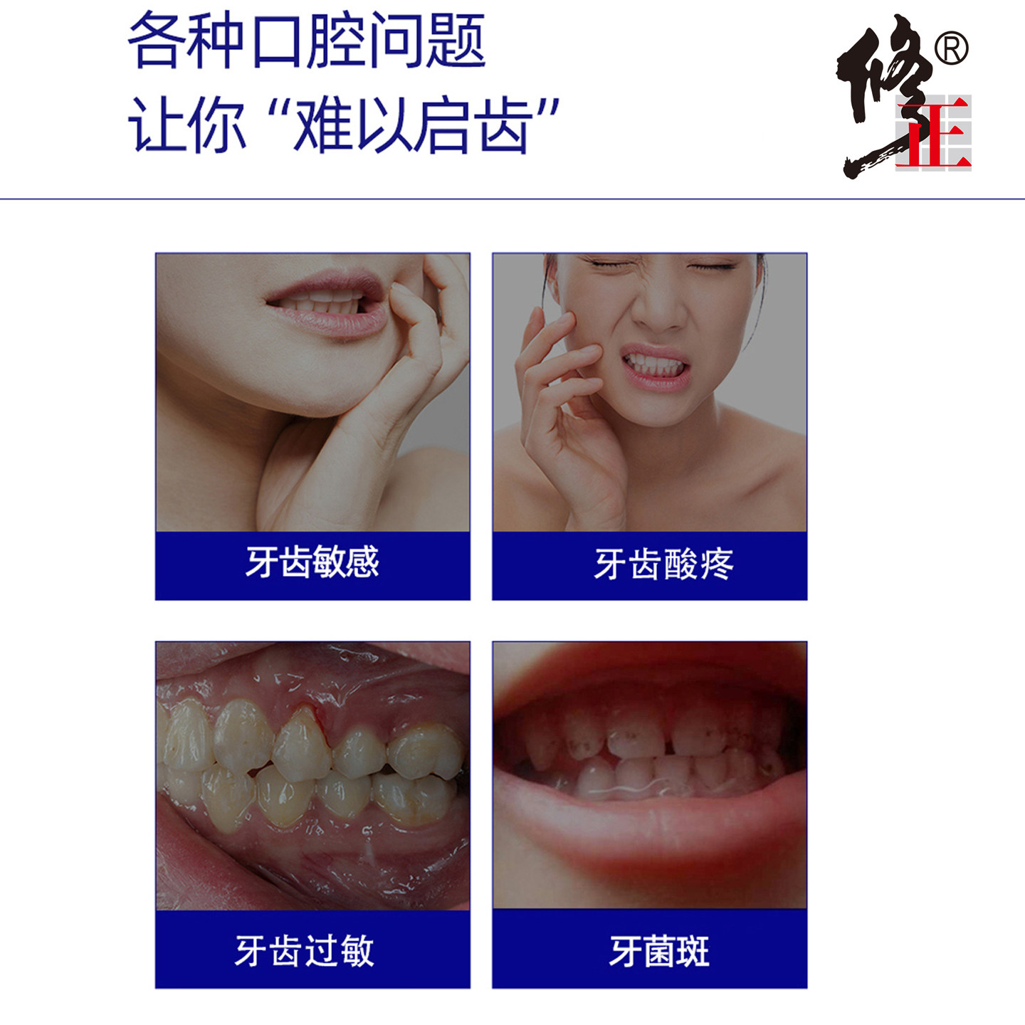 沃朗森医用口腔护理脱敏膏抗过敏牙膏状牙周炎医用型成人专用正品