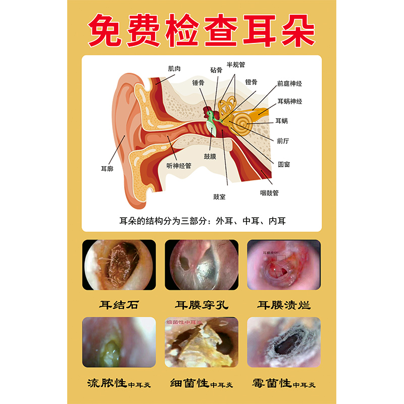 采耳图片中耳炎海报免费检查耳朵常见耳病症状挂图采耳店装饰挂画 - 图3