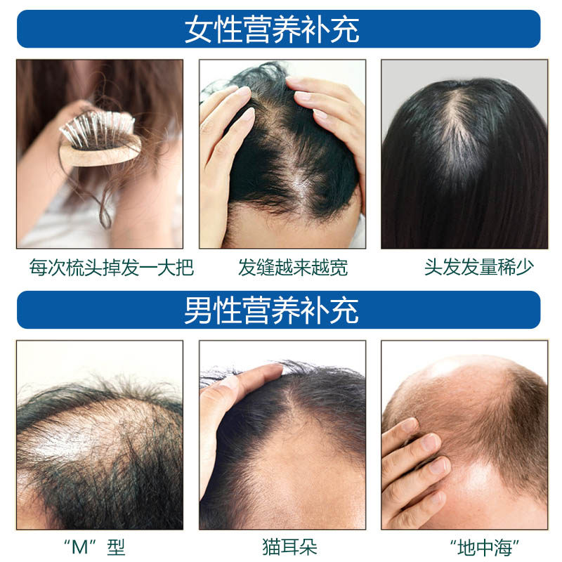 买3送1佳莱福锌硒维生素b6生物素 佳莱福旗舰锌/铁/硒
