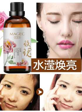 玫瑰按摩精油发热通经络买1送1
