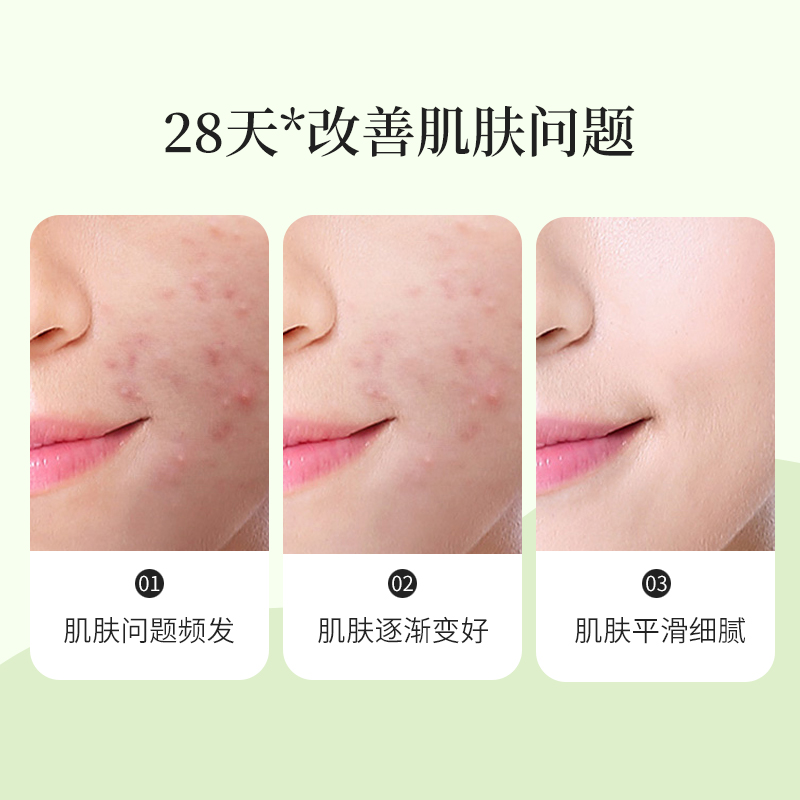 青蒿素苦参除螨洁面背部洗澡手工皂 艾儿身体皂