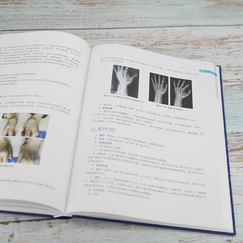 【新华正版】弧刃针疗法(精) 针灸康复 王学昌 针灸推拿 针灸方剂学 临床医学 针灸医案解读针灸临床笔记 清华大学出版社
