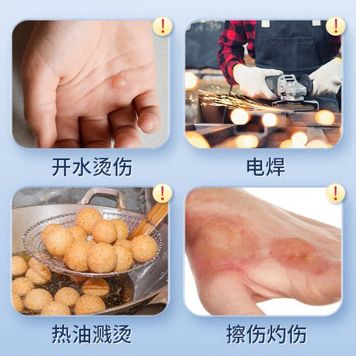 海氏海诺硅凝胶医用烫伤膏烧烫伤膏皮肤外用开水电焊供临床浅II度 - 图1