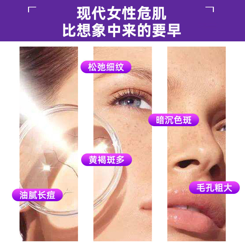 诺祯葡萄籽胶囊祛黄褐斑ce女花青素 诺祯葡萄籽提取物