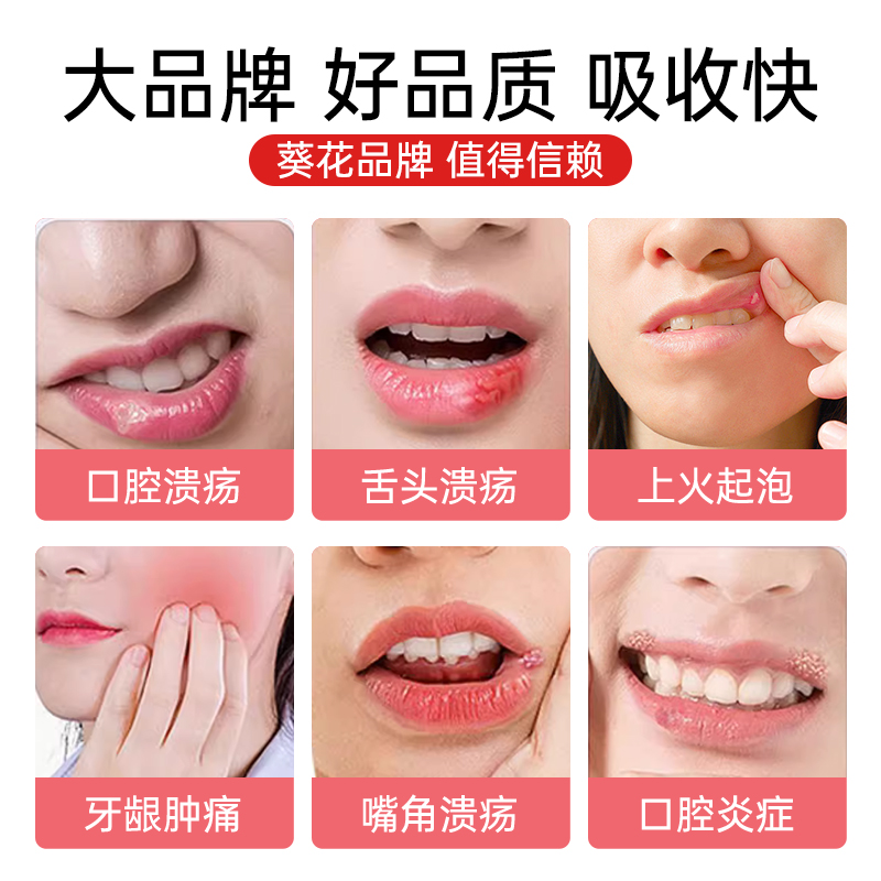 口腔潰瘍凝膠緩解疼痛舌頭起泡黏膜潰瘍牙齦腫痛口瘡嘴巴上火_萬道醫療器械旗艦店_醫療器械