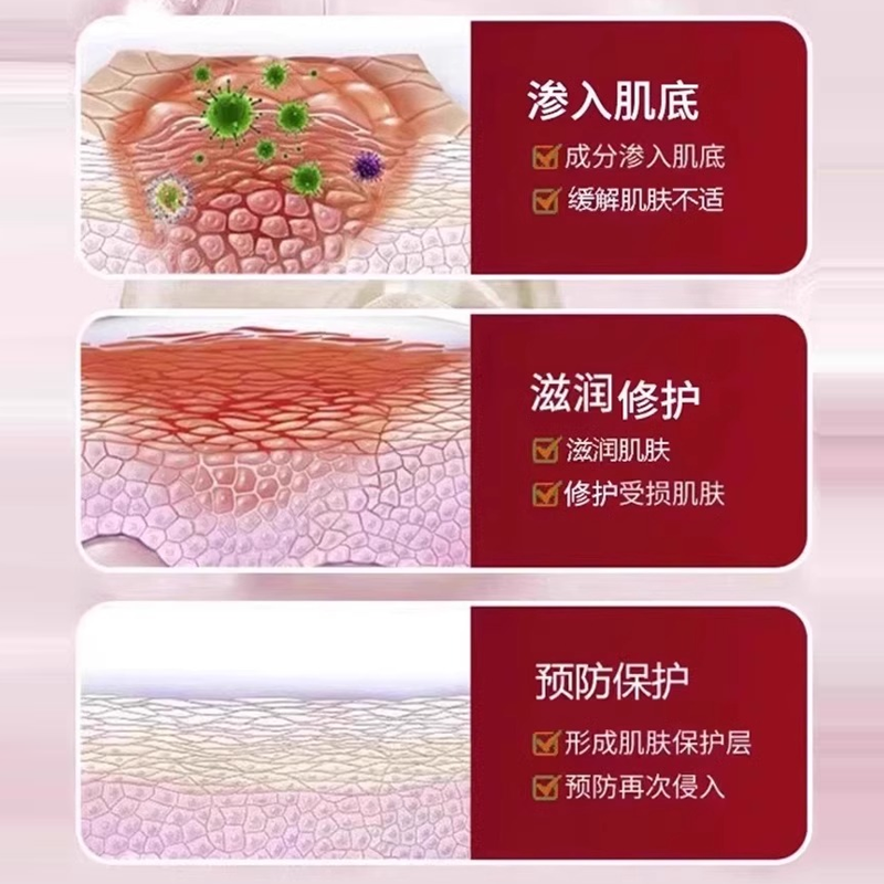 背上长痘痘后背毛囊炎去鸡皮肤磨砂膏沐浴露除螨止痒沐浴乳喷剂JW - 图2