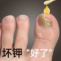 (Li Jiaqi recommended) Drop one drop of bad potassium net gray potassium to be good potassium old potassium old potassium Changxin A bad potassium gram