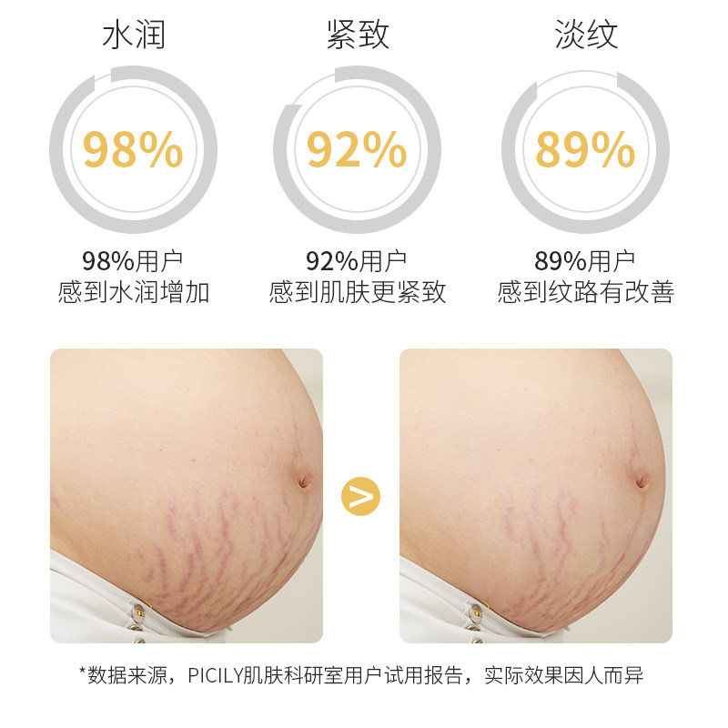 潘思莉日本孕妇专用预防淡化面膜 picily海外孕产妇腹膜