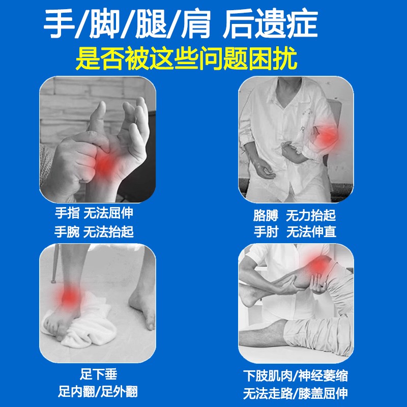 手部手指电动康复训练器材五指偏瘫中风恢复健仪臂胳膊脚功能锻炼 - 图0