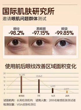 【眼部小熨斗】再见眼角纹 淡化黑眼圈 收缩眼袋提拉眼部男女通用