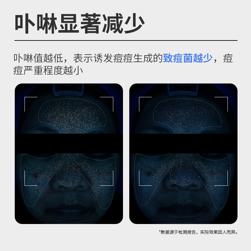 【天猫U先】希川科颜壬二酸控痘水祛痘保湿控油去角质去闭口50ml - 图0