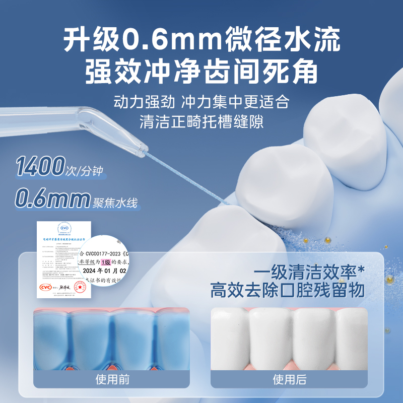 美的冲牙器家用洗牙器伸缩正畸专用口腔清洁牙齿清洗电动水牙线