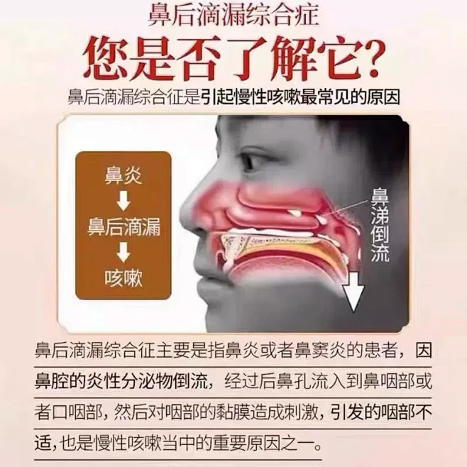 鼻涕倒流有痰咳嗽专用鼻窦炎鼻后滴漏综合症儿童药房同款喷雾剂JW - 图1