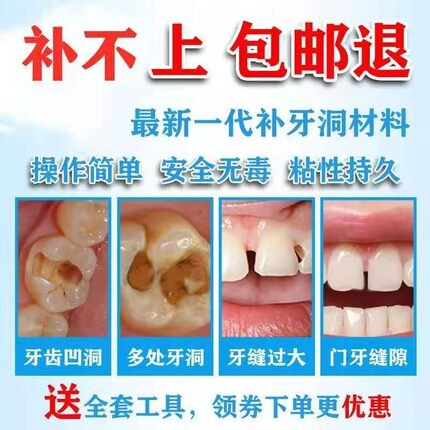 牙科材料动手粘烤瓷牙胶水牙洞钢牙套牙冠假牙牙科胶水补牙洞