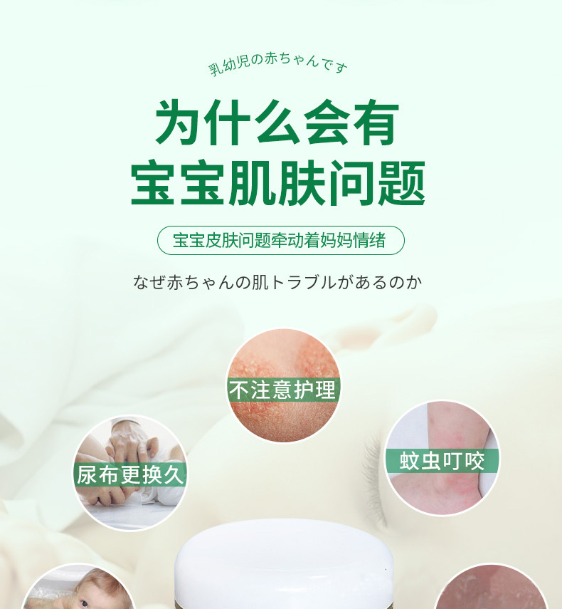 友堂婴宝湿疹膏儿童乳膏江西百灵生物宝宝乳膏皮肤外消红点皮炎瘙