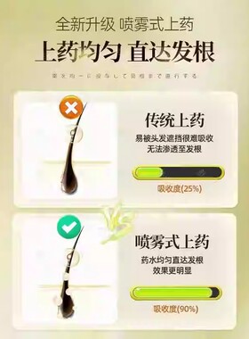 日本原装进口头皮上药器头部喷枪