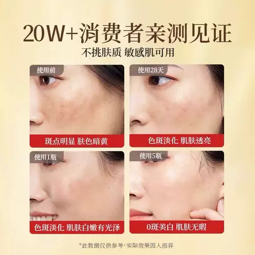 Гинзенд и узел мазь национальная медицина