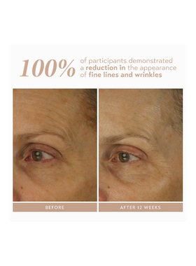 Shani Darden Skin Care RETINOL REFORM 面部精revolve小众新款