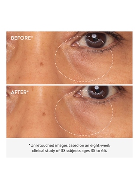Goop 3X RETINOL EYE LIFT SERUM 眼部精华REVOLVE小众
