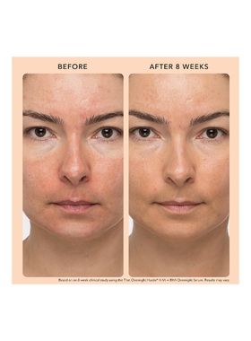 JLo Beauty That Overnight Hustle AHA + BHA ResurfacerREVOLVE