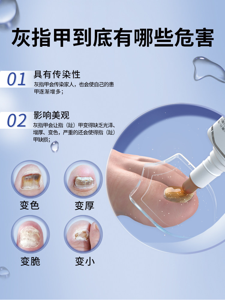 亮甲复方聚维酮碘4ml*4去液搽剂 楚蕴家庭医生大药房癣症