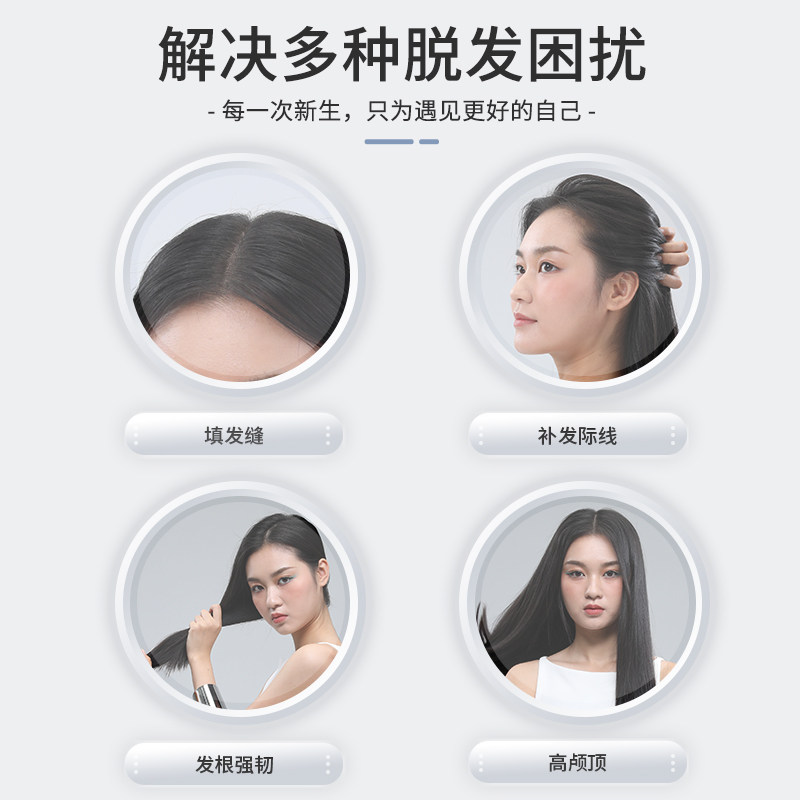 斯必申米诺地尔酊2%女防脱发搽剂 斯必申白发脱发
