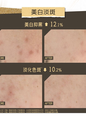 言之有物577美白淡斑面霜