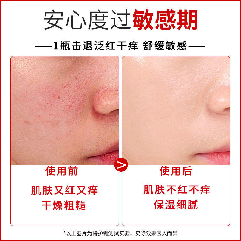 修正特护霜补水保湿舒缓修护霜面霜 大光明大药房面部健康