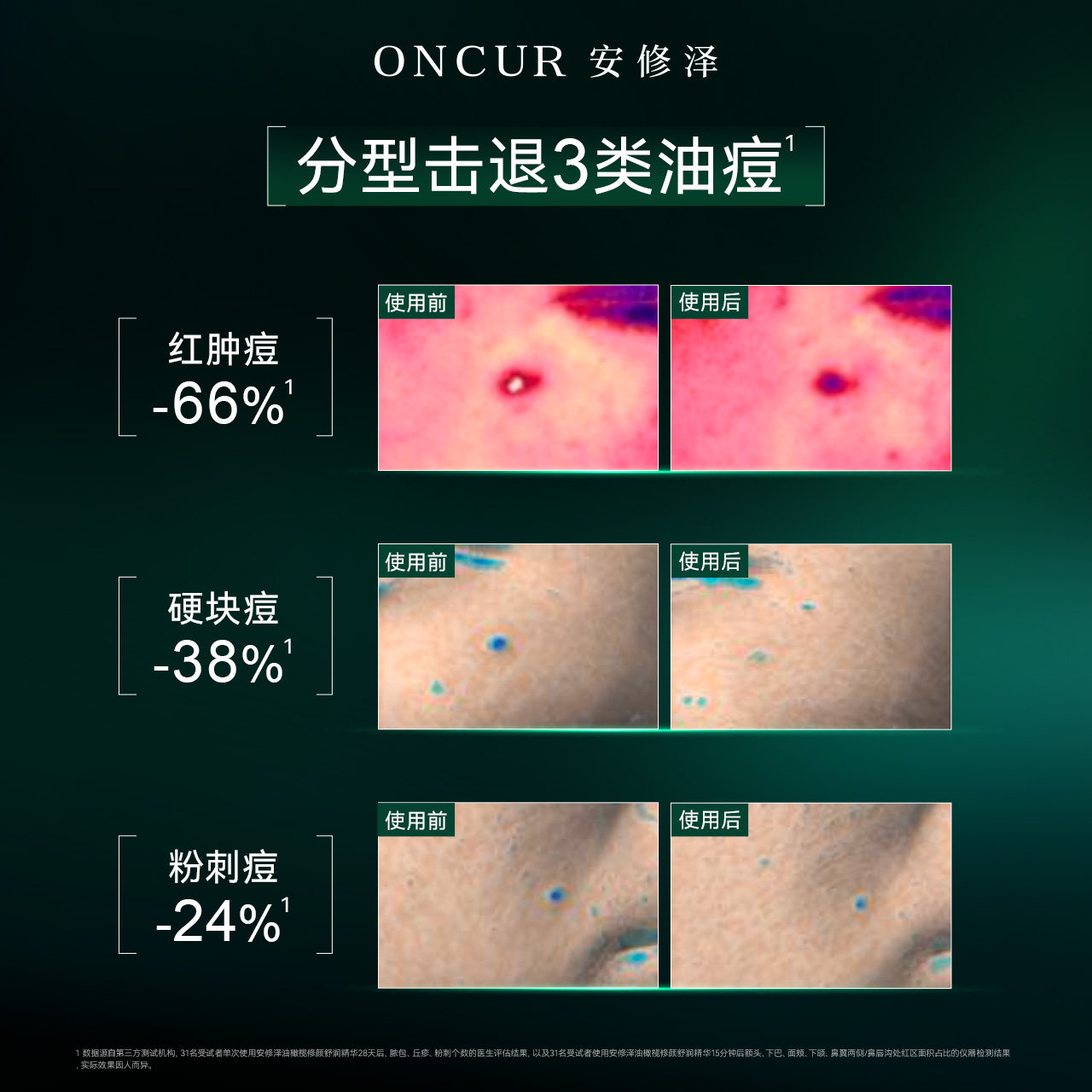 【七夕礼物】安修泽40%油橄榄因子精华液面部精华修护肌肤屏障