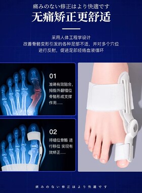 日本脚趾矫正器纠正脚骨突出神器