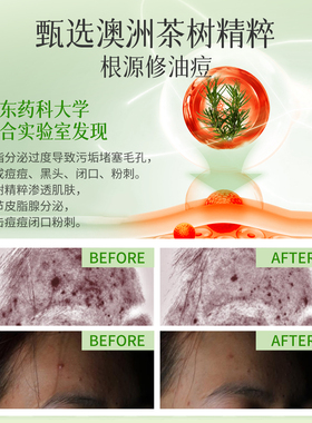 韩萃茶树水乳套装控油祛痘缩毛孔
