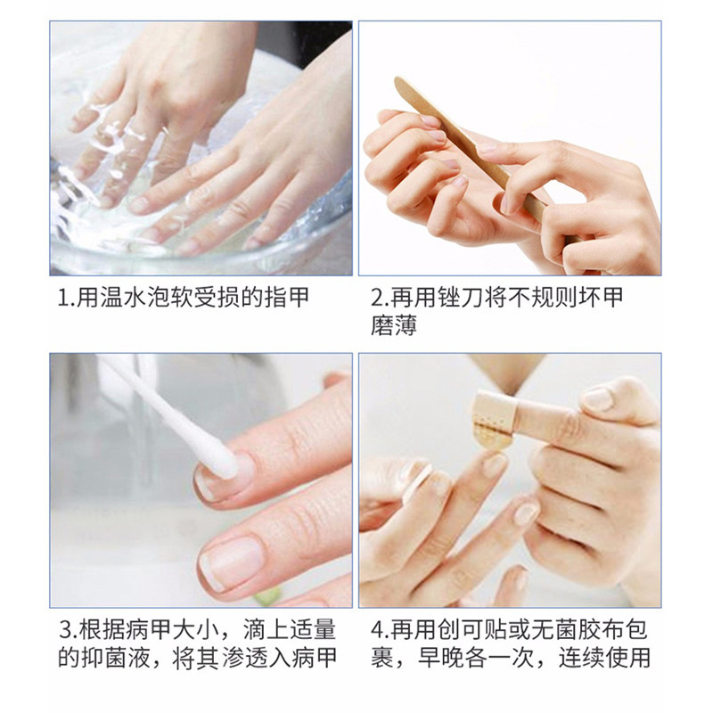 30冰醋酸涂剂稀释溶液喷剂灰冰乙酸外用液抗菌泡脚专用脱指甲膏,淘宝优惠券,粉丝福利购,淘宝优惠卷