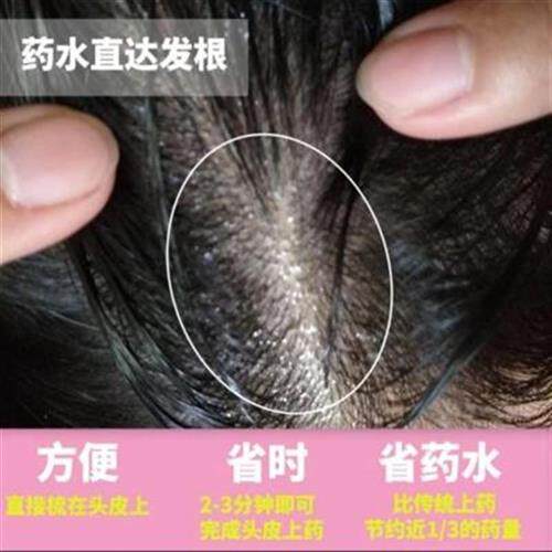 防脱发药水推荐品牌 新人首单立减十元 21年6月 淘宝海外