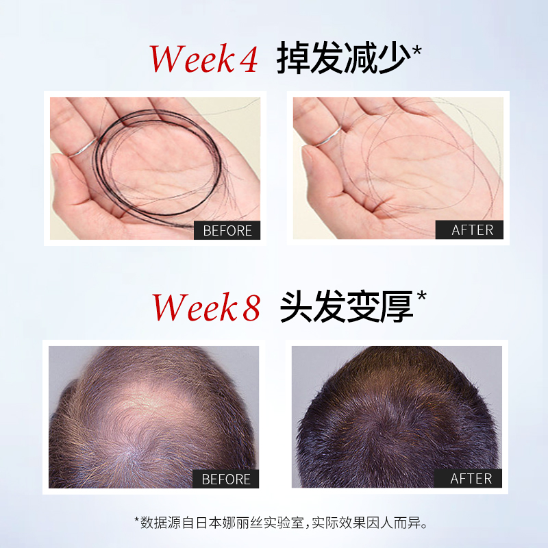 【会员专享】SGEX头皮精华30ml日本育发液抗脱控油毛囊脱发小黑瓶