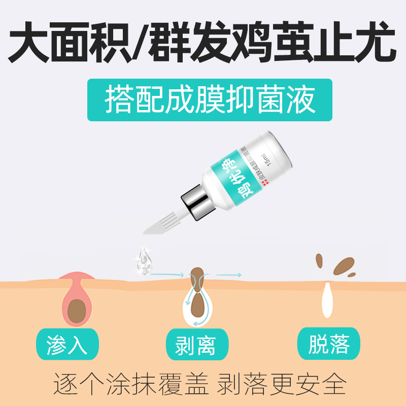 脚趾正品足部鸡尤净鸡眼膏鸡眼贴 天天特卖工厂店足部健康