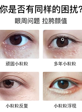 日本美人姫眼部小粒粒眼霜 眼周眼角汗管角质和汉精华tsubuporon