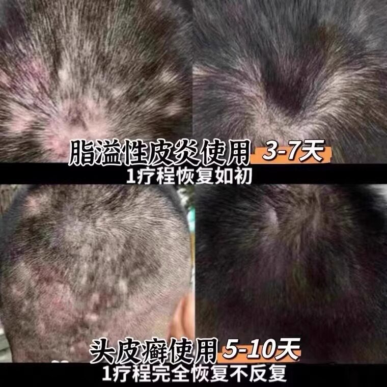  迪佰医疗器械保健理疗
