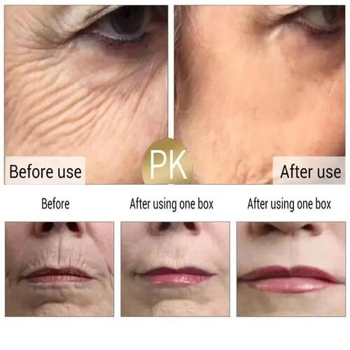 Retinol Wrinkle Remover Face Cream Firming Lifting Anti Agin - 图0