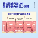 海洋至尊 Лечебная сыворотка по линии роста волос для кожи головы, здоровые волосы, уход за волосами, контроль жирного блеска, придает объем