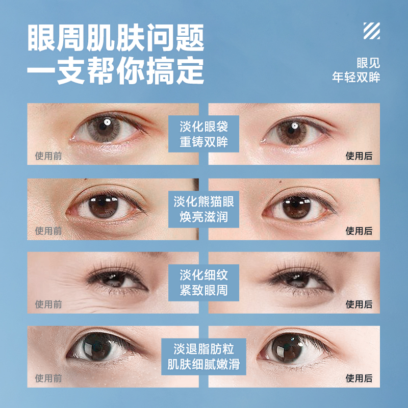 海洋至尊z男士熬夜紧致抗皱眼眼霜 海洋至尊男士眼霜