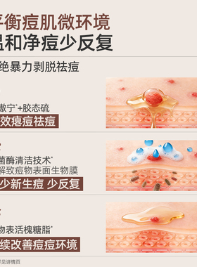 C咖祛痘洁面泡沫敏肌温和洗面奶