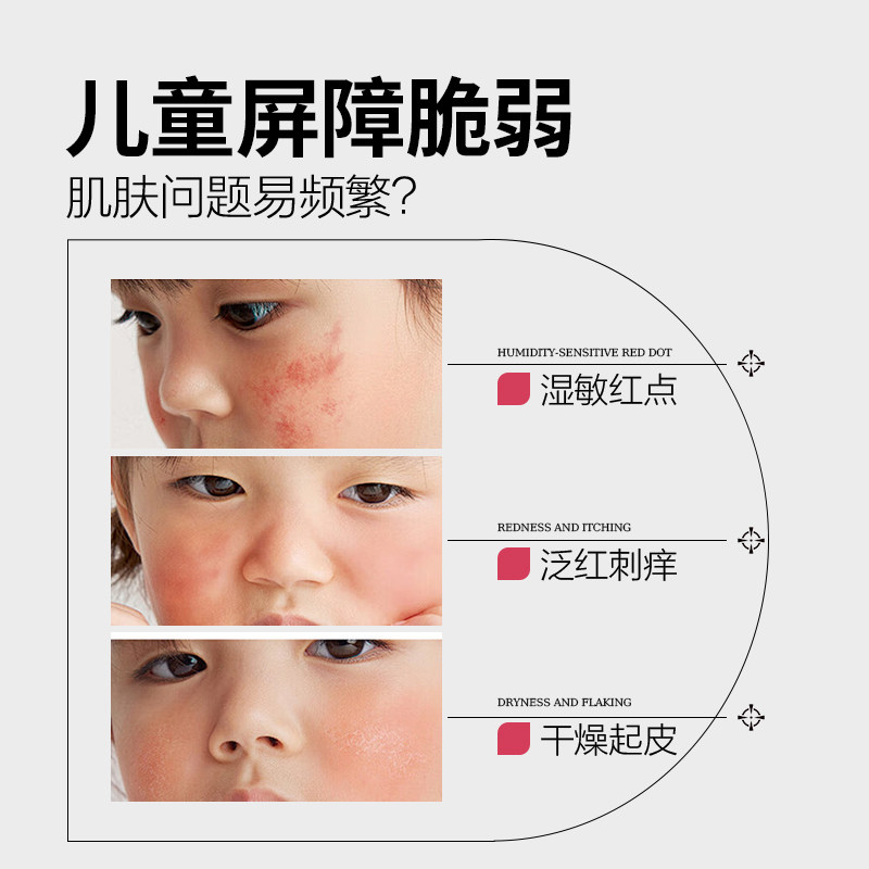 麦蒲花小安霜儿童湿痒舒敏干红特护霜保湿滋润宝宝婴亲霜润肤乳