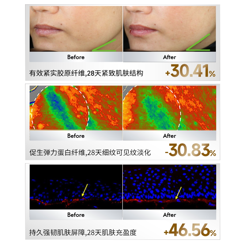 Sudee素玳 胶原蛋白水乳面霜3件套补水抗初老干皮敏感肌护肤组合