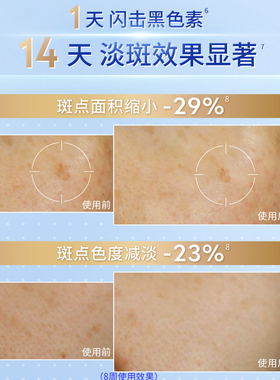 NIVEA luminous630® advanced anti dark-spot serum