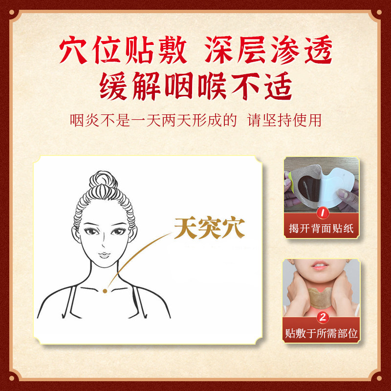 马寺源咽炎肿痛喷剂 马寺源膏药贴（器械）