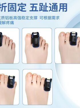 大母脚趾头小骨折固定器