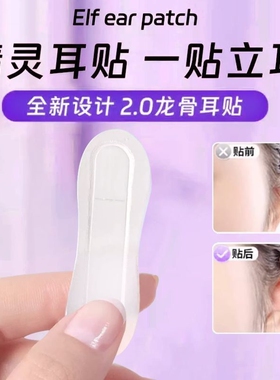 精灵耳贴强支撑龙骨定型贴面耳立耳朵支撑器隐形大显脸小不痛