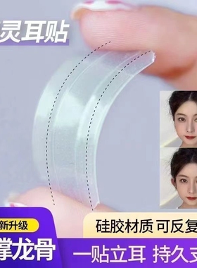 精灵耳贴强支撑升级龙骨亲肤不痛软硅胶立耳拍照神器耳朵定型贴